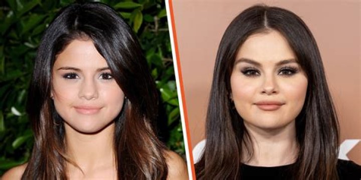 Fans are Convinced Selena Gomez had “Cat Eye Surgery” After her Golden Globes Performance