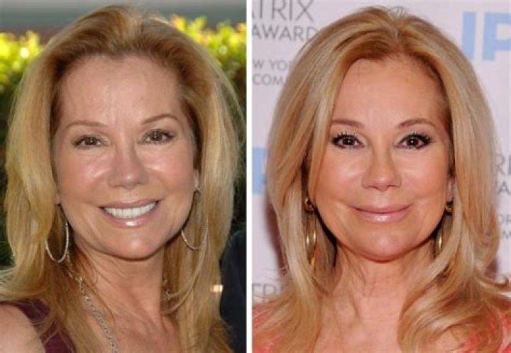Has Kathie Lee Gifford Had Plastic Surgery? Before And After Photos On IG